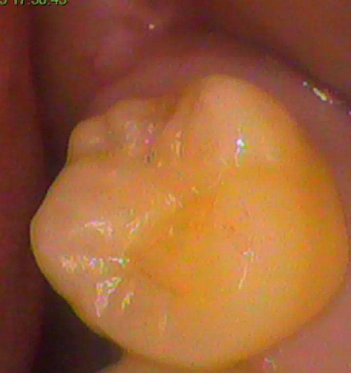 After